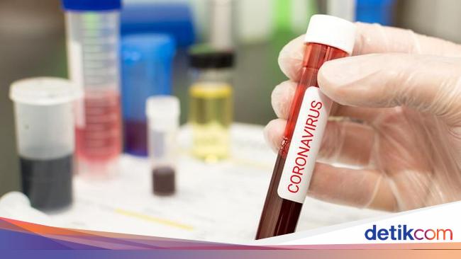 Banyak Yang Penasaran Obat Corona Ini Daftar Yang Pernah Diteliti