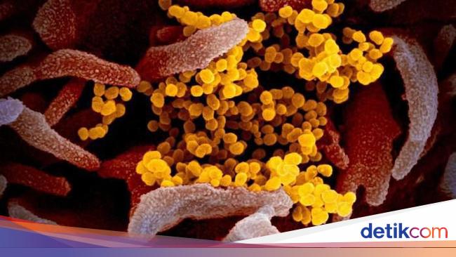 Ciri Ciri Virus Lengkap Dengan Pengertiannya Ciri Ciri Virus Lengkap Dengan Pengertiannya
