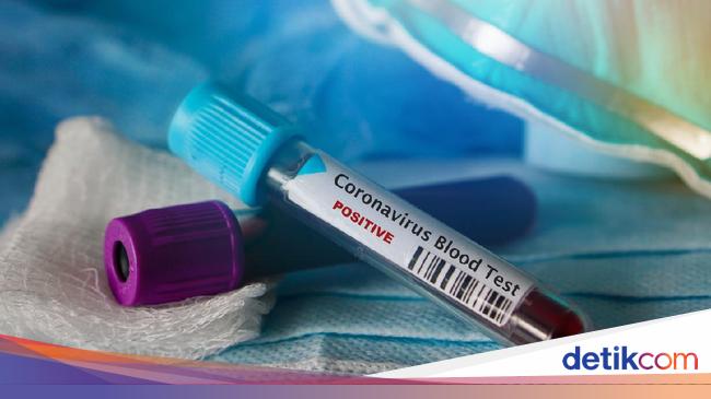 Gejala Dan Ciri Ciri Virus Corona Pada Bayi Dan Anak Wajib Waspada Gejala Dan Ciri Ciri Virus Corona Pada Bayi Dan Anak Wajib Waspada