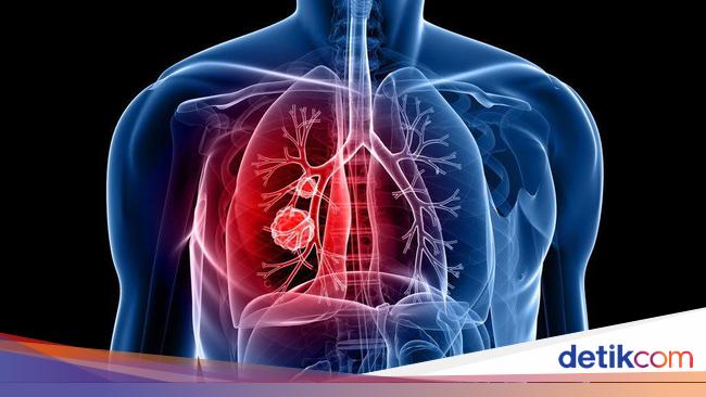 6 Organ Pernapasan Manusia Lengkap Beserta Fungsinya