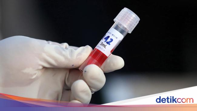 Pecah Rekor, Ini Sebaran 4.510 Pasien Corona yang Sembuh 30 September