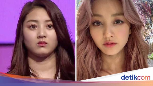 Perubahan Wajah Artis Korea Sebelum dan Sesudah Diet yang  Perubahan Wajah Artis Korea Sebelum dan Sesudah Diet yang