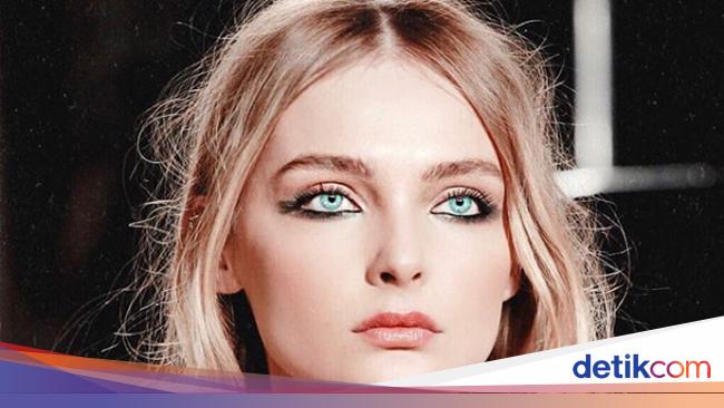 Foto: Top Model Dunia Ini Jadi Korban KDRT, 10 Tahun Dipukuli Suami