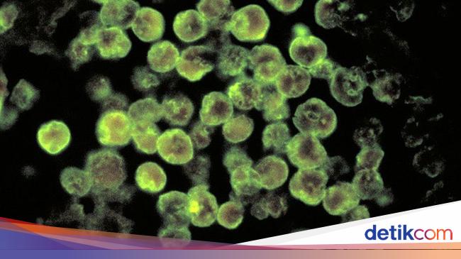 Chronology of a Man Killed by a Brain-eating Amoeba while washing his nose with tap water