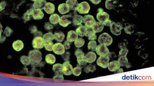 12 Fakta Amuba Pemakan Otak Yang Gemparkan Texas
