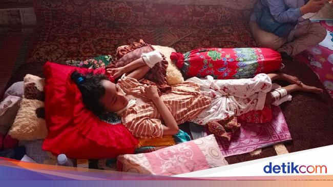 Derita Gizi Buruk Penyakit Kulit Gadis Kuningan Putus Sekolah