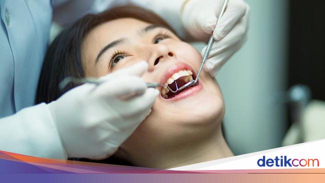 Nggak Cuma Bisa Bersihkan Karang Gigi Ini Manfaat Lain Dari Scaling Nggak Cuma Bisa Bersihkan Karang Gigi Ini Manfaat Lain Dari Scaling
