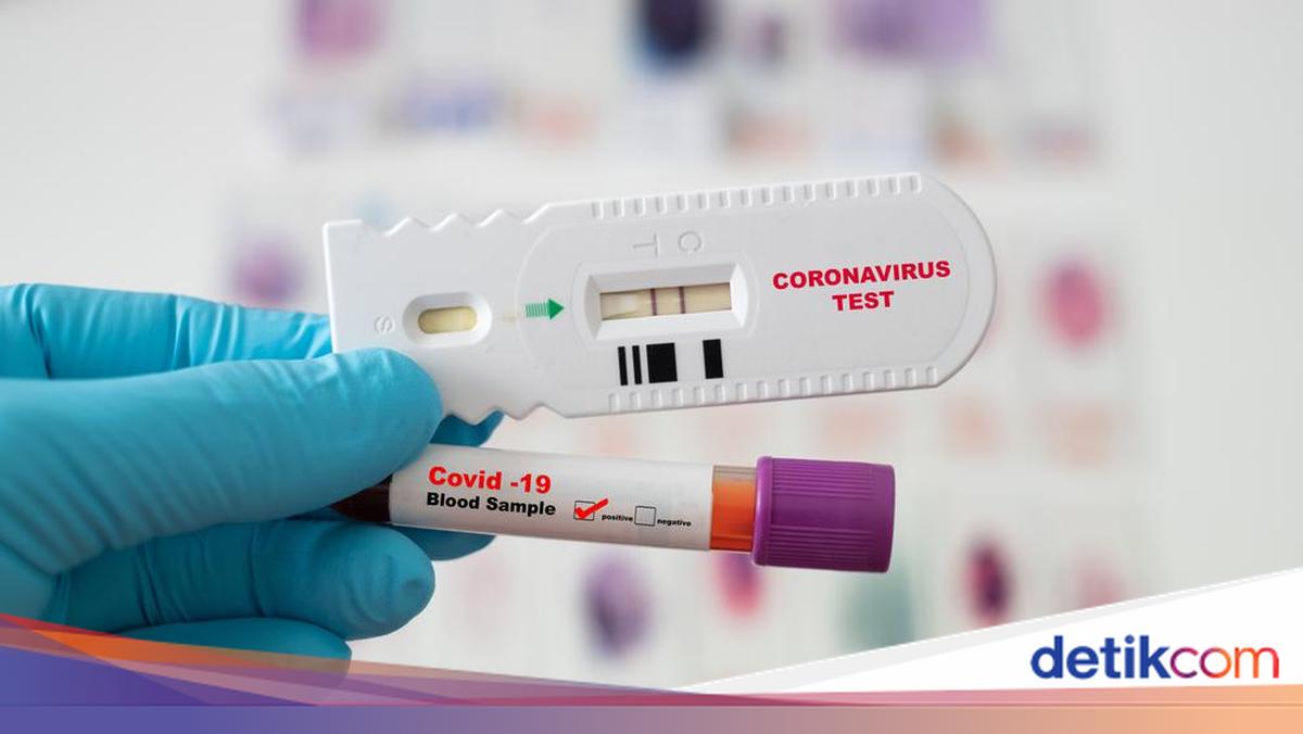 Libur Cuti Bersama, Keluar Masuk Riau Wajib Tunjukkan Hasil Rapid Test