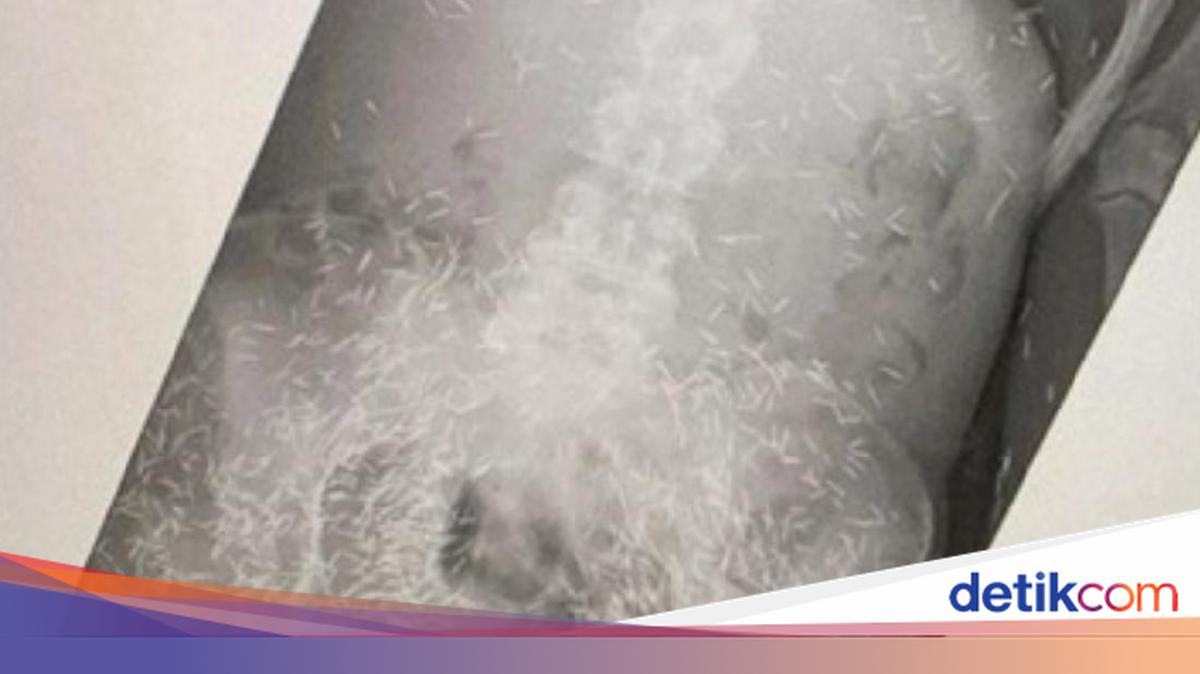 Tebranish eshak porno video Xmelnitskiydagi porno veb-kameralar