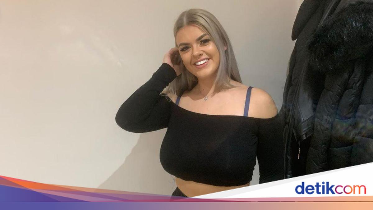 Derita Wanita Berukuran Bra I, Buka Donasi Agar Bisa Kecilkan Payudara