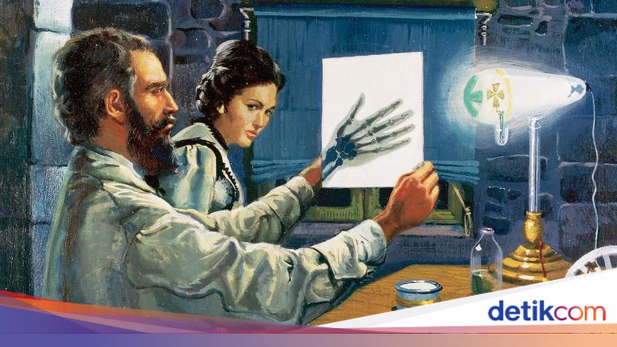 8 November Peringati Hari Radiologi Sedunia, Simak Sejarahnya