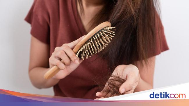 Jangan Dibiarkan, Segera Atasi Rambut Rontok dengan  