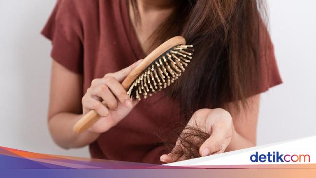 Jangan Dibiarkan Segera Atasi Rambut Rontok Dengan Perawatan Tepat