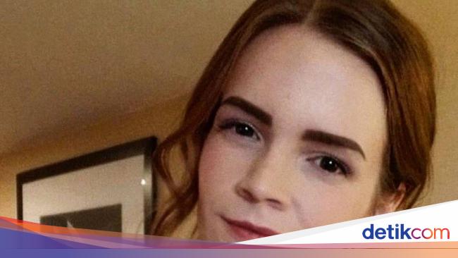 Foto: Wanita Viral Mirip Emma Watson Hingga Sulit ...