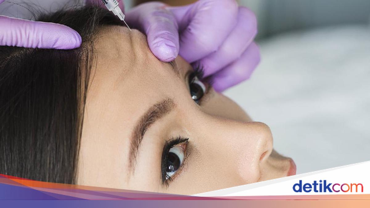 Botox Mahal Ini Perawatan Botox Ini Tren di Kalangan Artis KPop yang Ingin Tampil Sempurna
