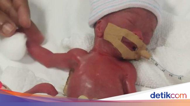 Apres 13 Mois A L Hopital Le Plus Petit Bebe Du Monde Peut Enfin Rentrer A La Maison Nouvelles Du Monde Apres 13 Mois A L Hopital Le Plus Petit Bebe Du Monde Peut Enfin Rentrer A La Maison Nouvelles Du Monde