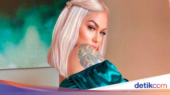 Cerita Model yang Keracunan Implan Payudara dan Hampir Mati