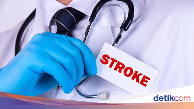 Know the symptoms, causes and facts about stroke