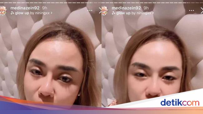 Medina Zein Tampil Lepas Hijab, Pakai Piyama Louis Vuitton di Kasur