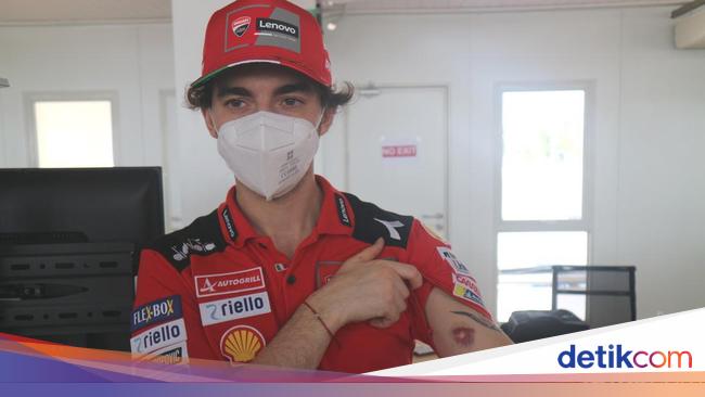 Pecco Bagnaia shows off his bruised arm after riding a motorbike at the Mandalika Circuit