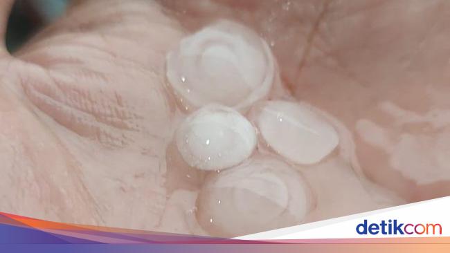 The size of the hail in Surabaya is the size of a marble to the fingernails of an adult