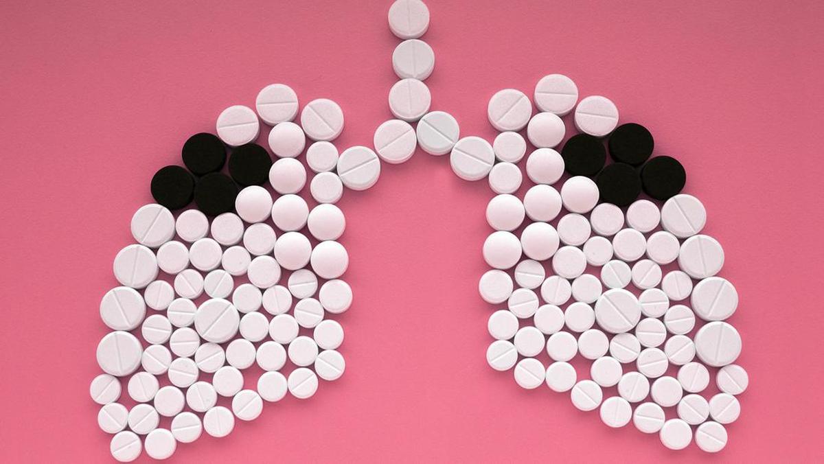 5 Ciri TBC yang Beda dari Flu Biasa, Jangan Sampai Salah Obat