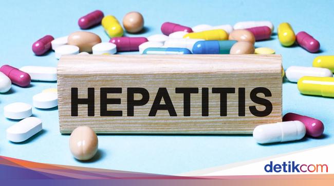 Apa Sih Itu Hepatitis Fulminan Cek Gejala Penyebab Dan Pengobatan 1862