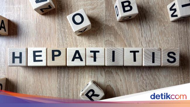 Beware of ‘Mysterious’ Hepatitis in Indonesia, IDI-IDAI Reveals Symptoms