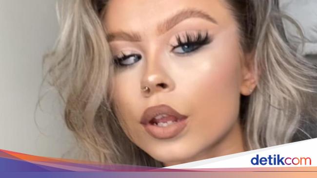 Potret Selebgram yang Viral di TikTok. PD Bikin Konten dengan Mata Juling