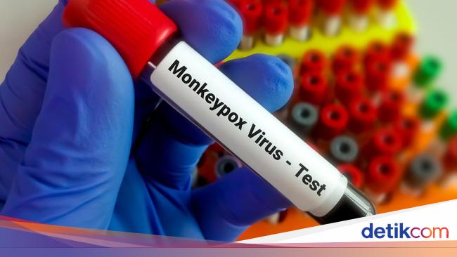 Pulomerak Health Center Banten Reports Suspected Smallpox Monkey, Here Are the Symptoms