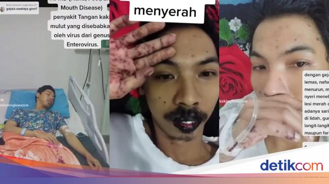 Viral Chronology of Madiun Man Gets Flu Singapore After Stomach Pain