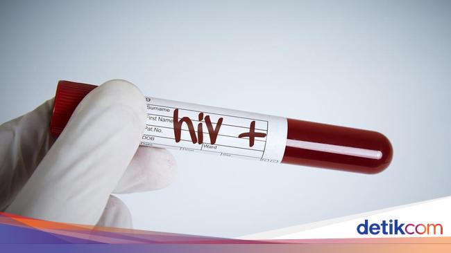 Kenali 10 Tanda yang Menunjukkan Orang Terinfeksi HIV