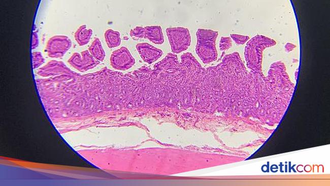Jenis-jenis Jaringan Epitel