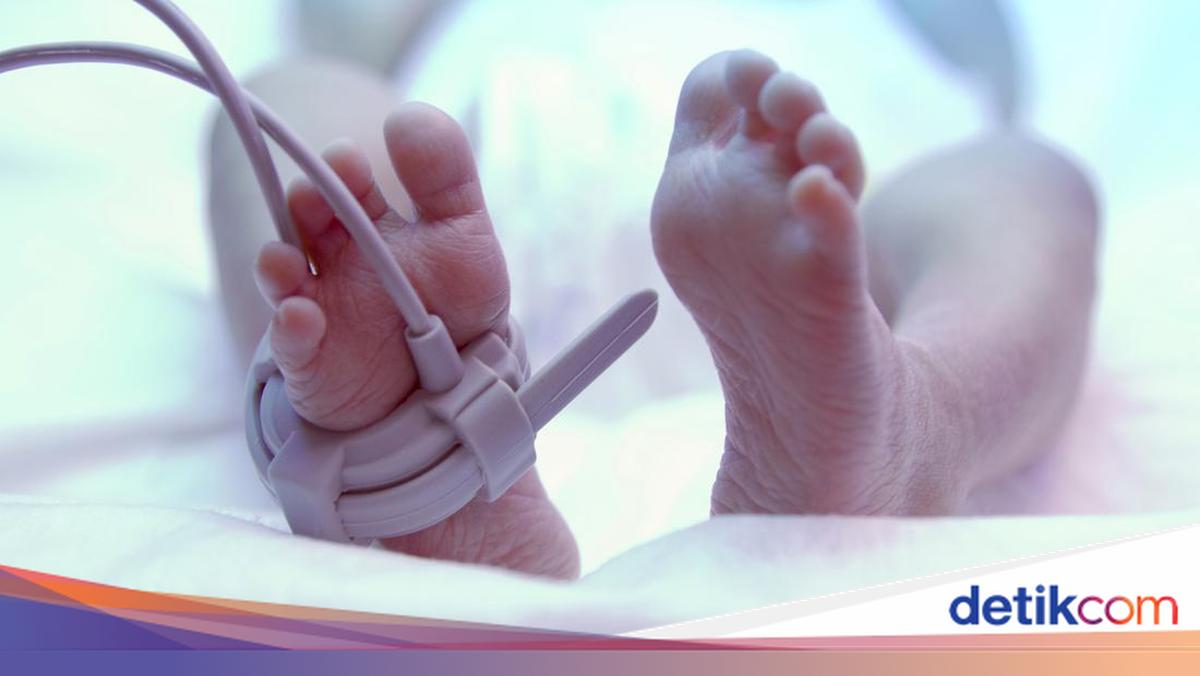 RSUD Prambanan Bakal Klarifikasi ke Polisi soal Balita Meninggal Usai CT Scan
