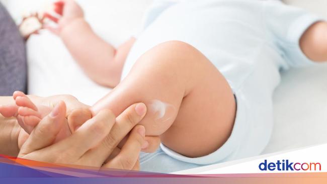 Dokter Tegaskan Kulit Bayi Bersisik karena Bumil Doyan Minum Es Cuma Mitos