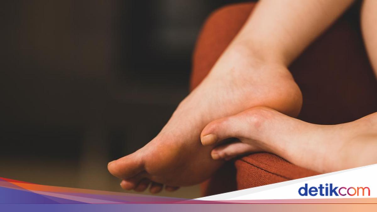Cara Mengatasi Kutu Air Secara Alami dan Medis agar Cepat Kering