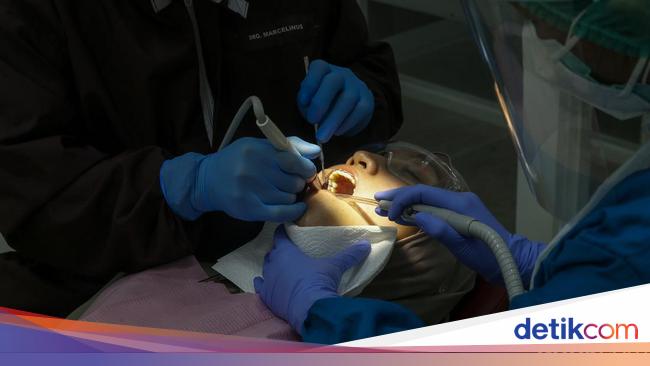 Sampai Picu Kematian, Ini Komplikasi Gigi Bolong yang Harus Diwaspadai