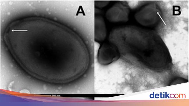 Climate Change Could Unleash Ancient Viruses from Melting Ice Sheets: Scientists Issue Dire Warning