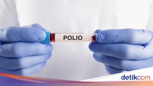 Kemenkes Sebut Ada 12 Kasus Lumpuh Layu Akibat Polio di RI, Ini Sebarannya