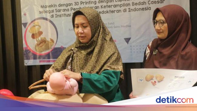 Manekin Bedah Sesar Unair Dapat Dana Matching Fund Bantu Calon Dokter