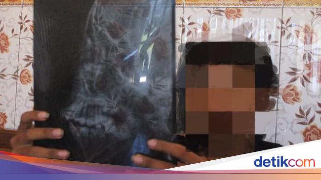 Middle School Students in Jombang Beaten by Group of Pesilat Fighters to Breaking Bones