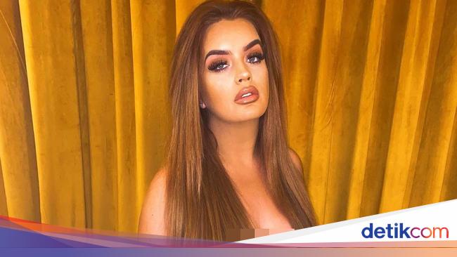 Transformasi Wanita yang Menang Lotre Rp 19 M, Gayanya Glamor Tapi