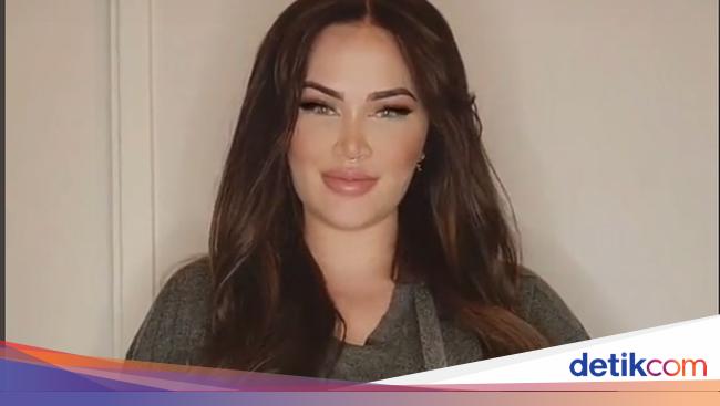 Heboh Wanita Payudaranya Tak Berhenti Tumbuh, Inikah Penyebab