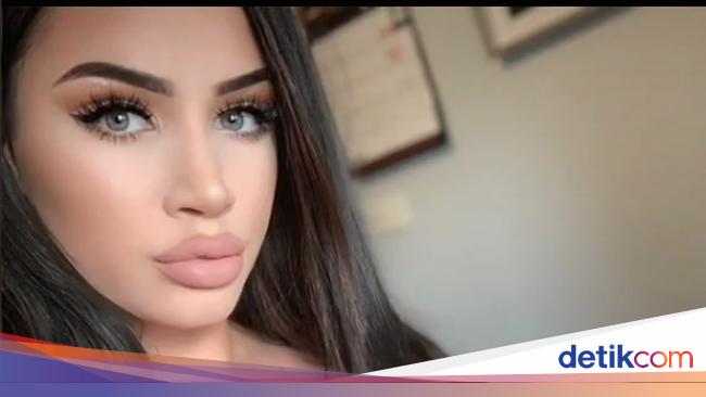 Wanita Idap Gigantomastia, Payudara Tak Berhenti Tumbuh Berakhir