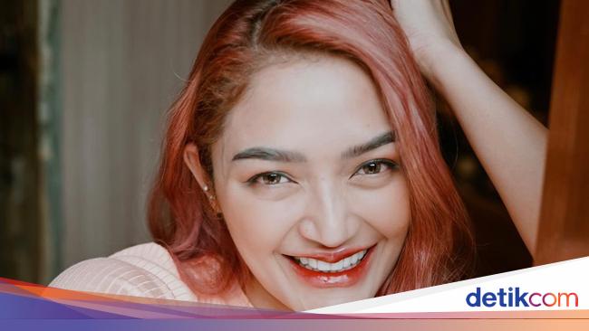 7 Foto Siti Badriah Makin Cantik Dengan Veneer And Filler Bibir Dituding