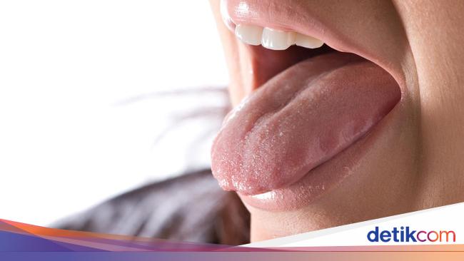 9 Penyebab Lidah Terasa Kebas, Bisa karena Alergi Makanan hingga Stroke