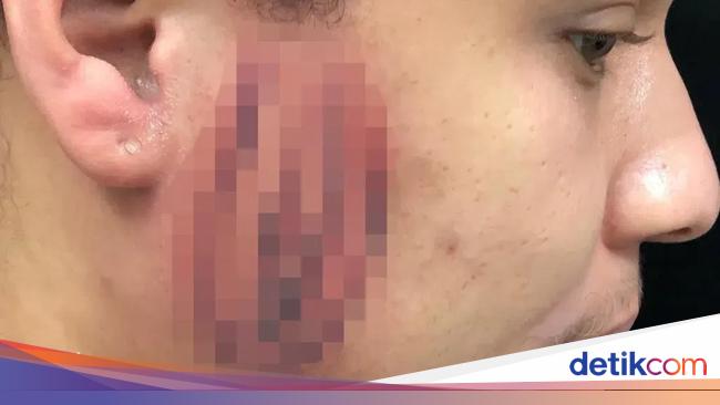 Viral Men Desperate for Vaginal Tattoos on Face, Called Unable to Work