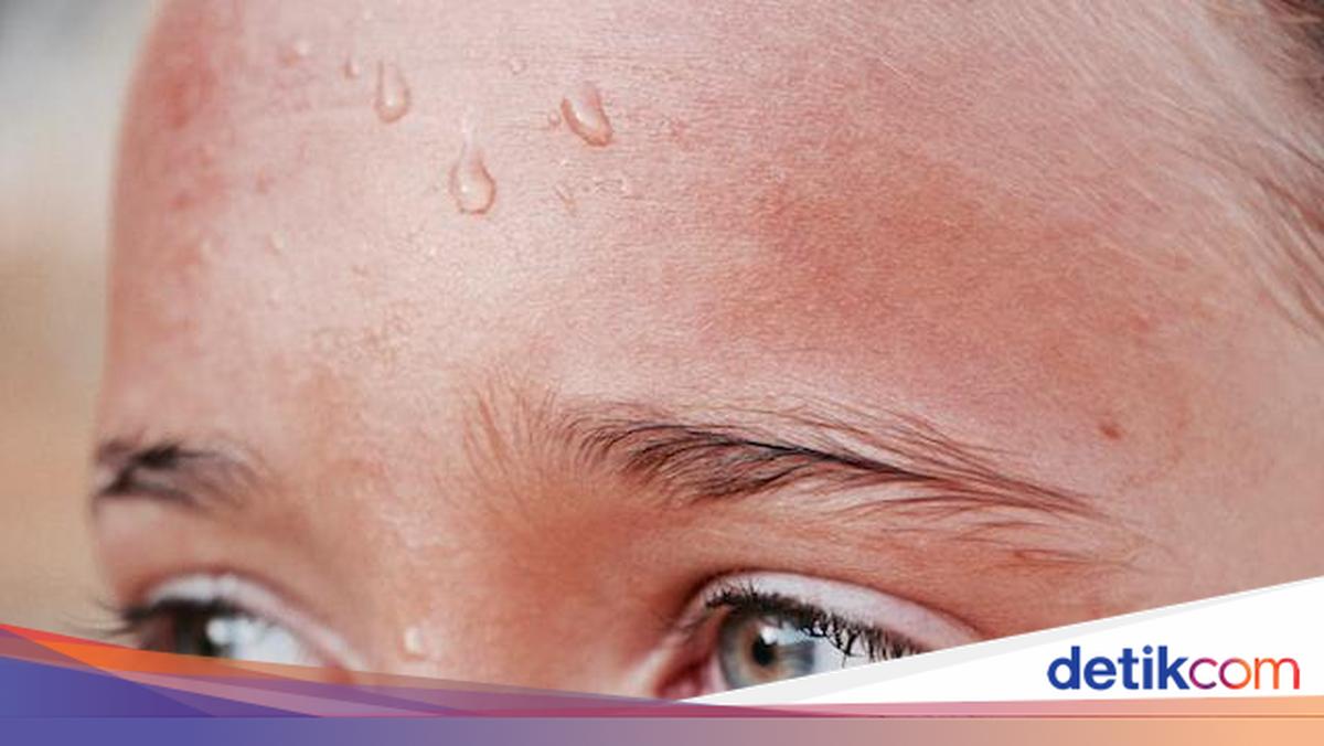 Pengertian Sekresi, Contoh, dan Perbedaannya dengan Ekskresi