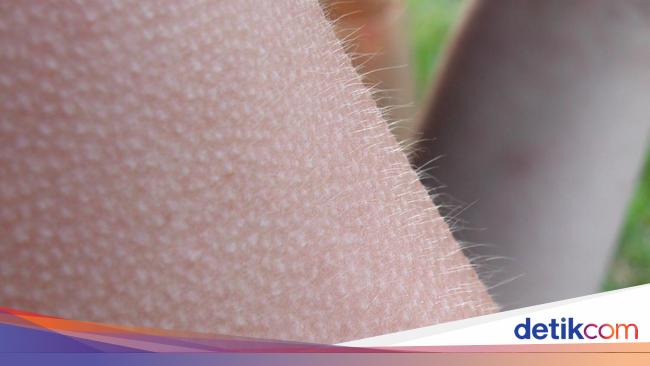 Merinding Trail Mengapa Kita Bisa Merinding? Begini Penjelasan Ilmiahnya