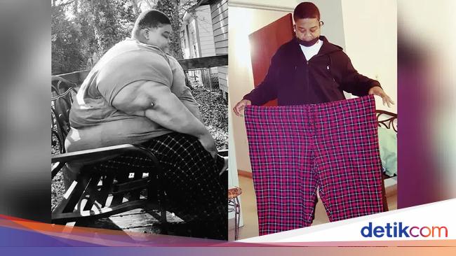 Applying a Calorie Deficit Diet, This Man Managed to Lose 165 Kg